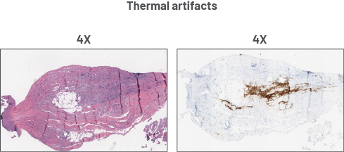 Preanalytical artifacts
